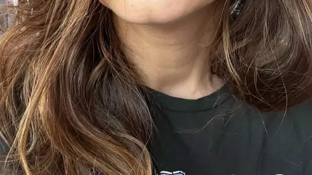 Rubina Dilaik के चेहरे का हुआ बुरा हाल, सूजी आंखें देख हैरान हुए फैंस