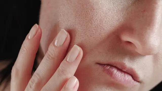 Skin Care Tips