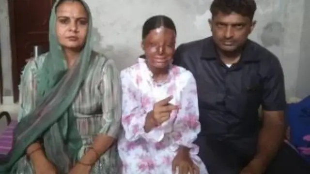 Life Success Story: एसिड अटैक से चली गई आंखें, लेकिन नहीं हारी हिम्मत, 10वीं परीक्षा में किया टॉप